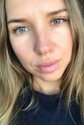 Bild von Albina